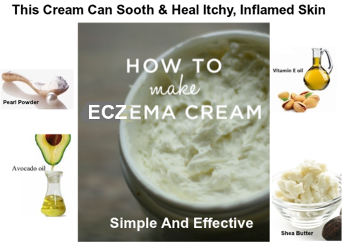 Eczema Cream