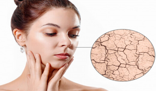 How To Treat Dry Skin On Your Face?